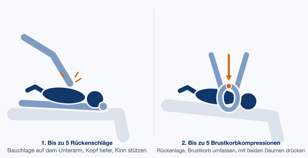 Illustration: Säugling liegt bäuchlings auf dem Unterarm, eine Hand schlägt zwischen die Schulterblätter; daneben liegt der Säugling auf dem Rücken, beide Hände umfassen den Brustkorb und die Daumen drücken auf das Brustbein.