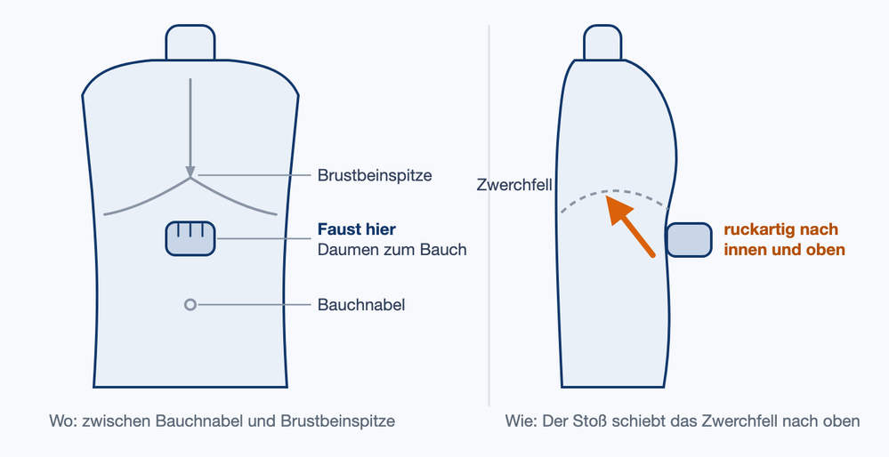 Illustration des Oberkörpers: Faust zwischen Bauchnabel und Brustbeinspitze; in der Seitenansicht zeigt ein Pfeil den ruckartigen Druck nach innen und oben Richtung Zwerchfell.