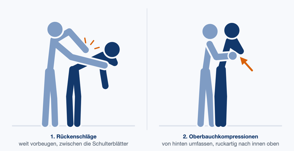 Illustration: Eine helfende Person schlägt einer vorgebeugten Person zwischen die Schulterblätter; daneben umfasst sie die Person von hinten und drückt die Faust in den Oberbauch.