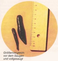 Blutegeltherapie
