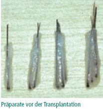 Präparate vor der Transplantation
