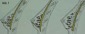 Abb. 1